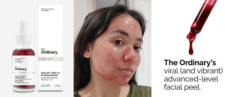 Review Lengkap The Ordinary AHA 30% + BHA 2% Peeling Solution
