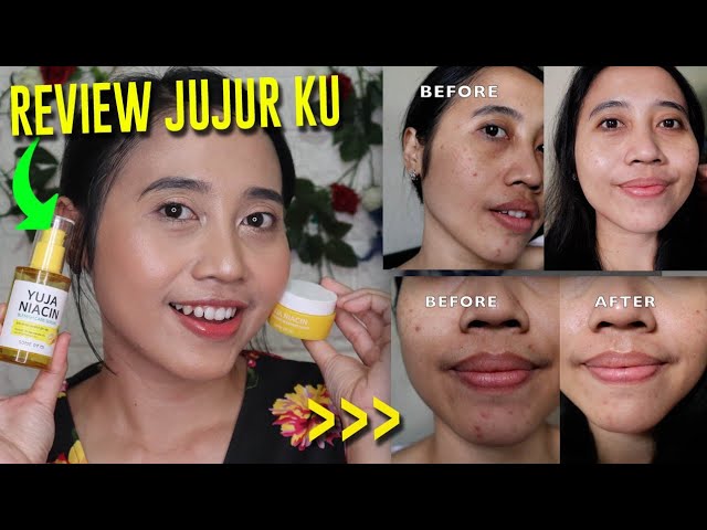 Review Serum Anti Jerawat Yuja Niacin dari SOME BY MI